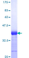 12.5% SDS-PAGE Stained with Coomassie Blue.